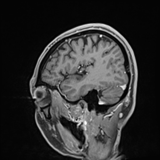 Click on the Serie image to view the images of VILLANUEVA, WILLIAM A.